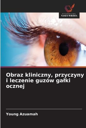 Obraz kliniczny, przyczyny i leczenie guzów galki ocznej