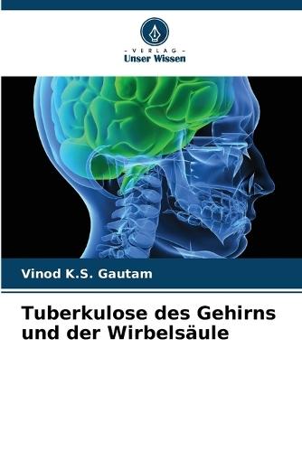 Tuberkulose des Gehirns und der Wirbelsäule