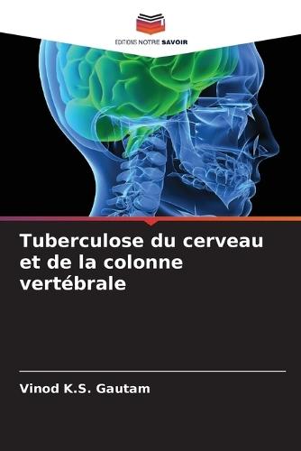 Tuberculose du cerveau et de la colonne vertébrale