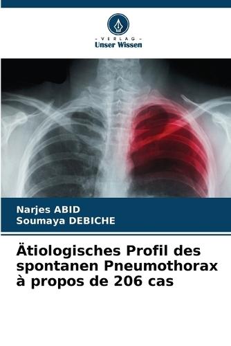 Ätiologisches Profil des spontanen Pneumothorax à propos de 206 cas