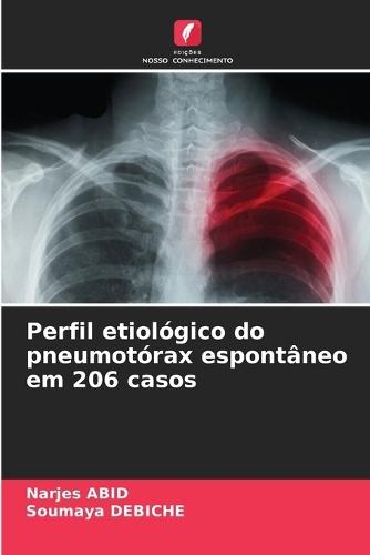 Perfil etiológico do pneumotórax espontâneo em 206 casos