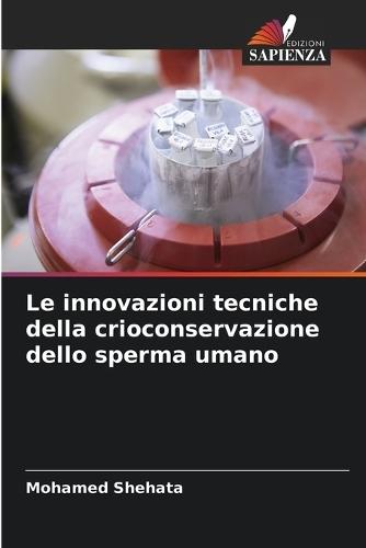 Le innovazioni tecniche della crioconservazione dello sperma umano
