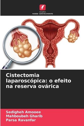 Cistectomia laparoscópica: o efeito na reserva ovárica
