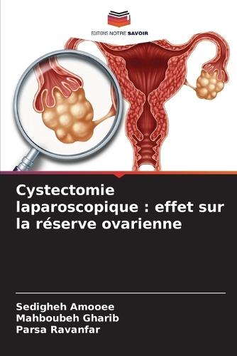 Cystectomie laparoscopique: effet sur la réserve ovarienne