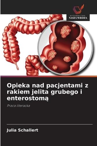 Opieka nad pacjentami z rakiem jelita grubego i enterostomą