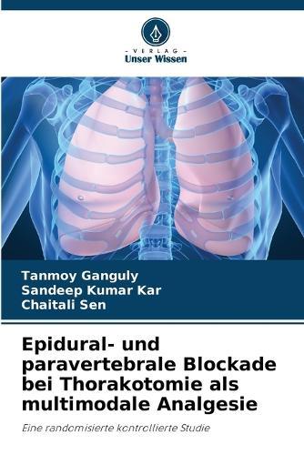 Epidural- und paravertebrale Blockade bei Thorakotomie als multimodale Analgesie