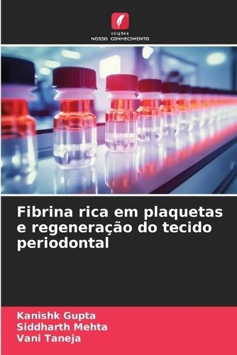 Fibrina rica em plaquetas e regeneração do tecido periodontal