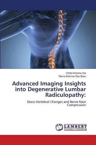 Advanced Imaging Insights into Degenerative Lumbar Radiculopathy
