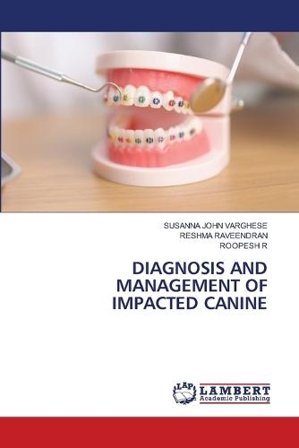 Diagnosis and Management of Impacted Canine