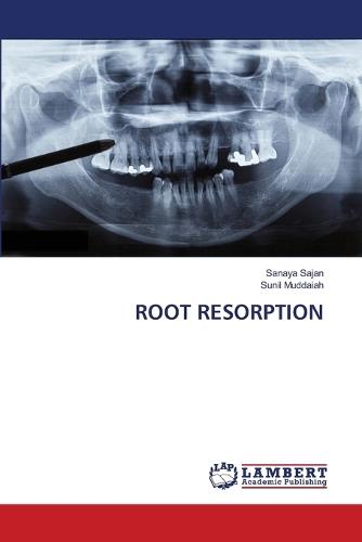 Root Resorption