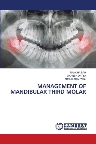 Management of Mandibular Third Molar