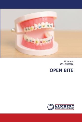 Open Bite