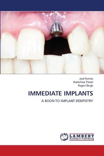 Immediate Implants