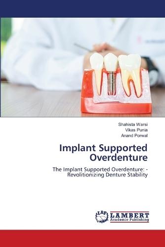 Implant Supported Overdenture