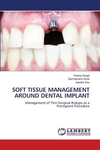 Soft Tissue Management Around Dental Implant