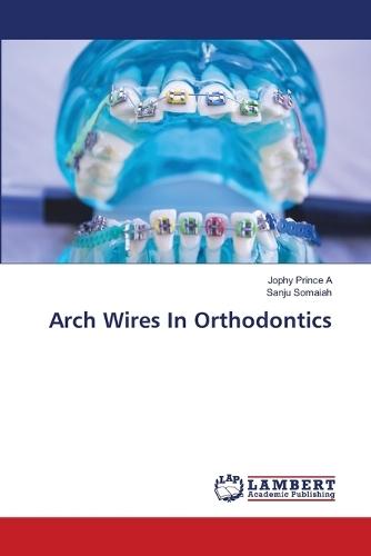 Arch Wires In Orthodontics