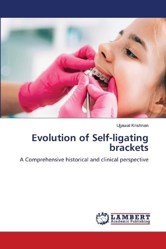 Evolution of Self-ligating brackets