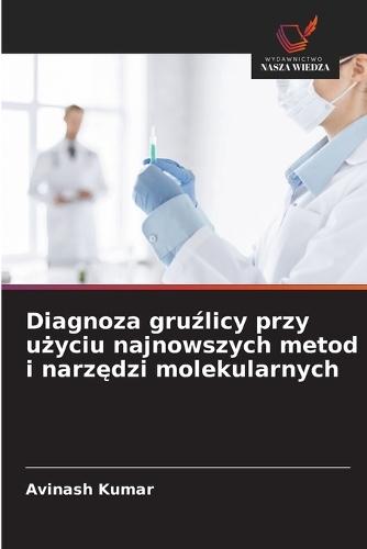 Diagnoza gruźlicy przy użyciu najnowszych metod i narzędzi molekularnych