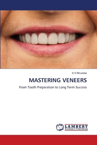 Mastering Veneers