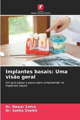 Implantes basais: Uma visão geral