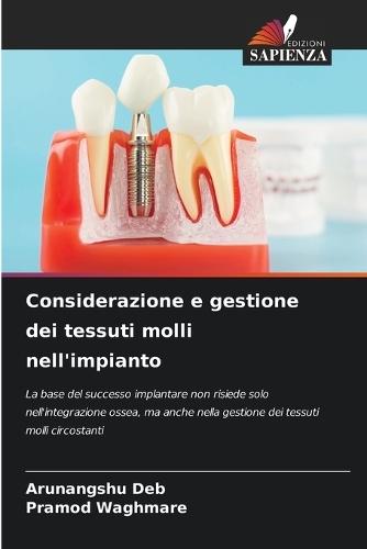 Considerazione e gestione dei tessuti molli nell'impianto
