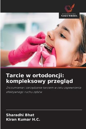 Tarcie w ortodoncji: kompleksowy przegląd