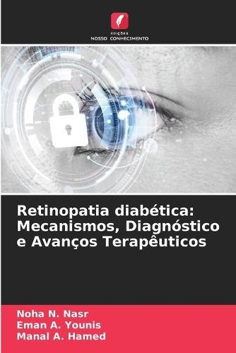 Retinopatia diabética: Mecanismos, Diagnóstico e Avanços Terapêuticos