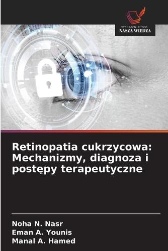 Retinopatia cukrzycowa: Mechanizmy, diagnoza i postępy terapeutyczne