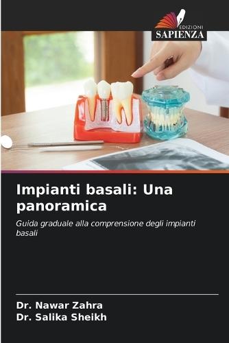 Impianti basali: Una panoramica