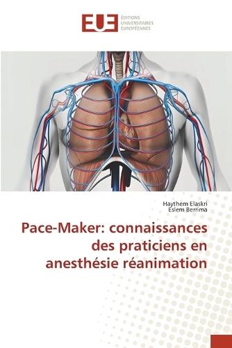 Pace-Maker: connaissances des praticiens en anesthésie réanimation