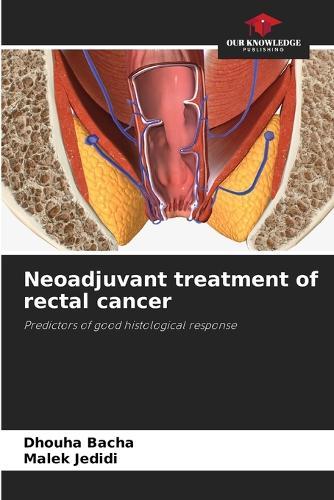 Neoadjuvant treatment of rectal cancer