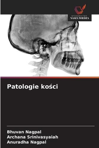 Patologie kości