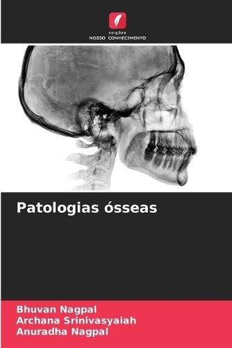 Patologias ósseas