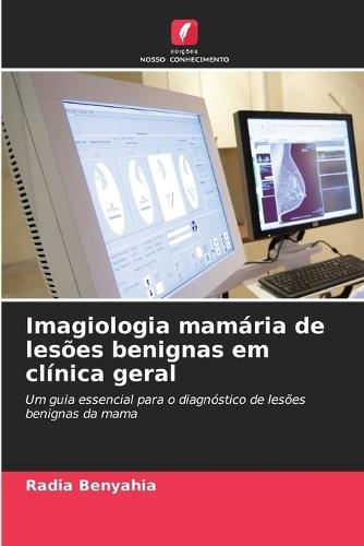Imagiologia mamária de lesões benignas em clínica geral