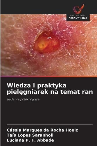 Wiedza i praktyka pielęgniarek na temat ran