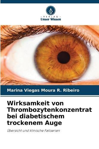 Wirksamkeit von Thrombozytenkonzentrat bei diabetischem trockenem Auge
