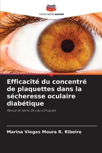 Efficacité du concentré de plaquettes dans la sécheresse oculaire diabétique