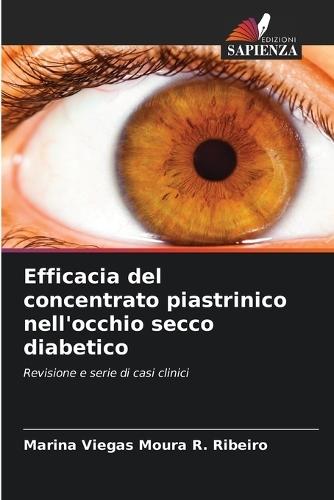Efficacia del concentrato piastrinico nell'occhio secco diabetico