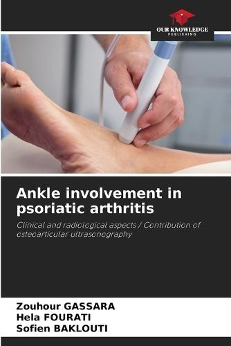 Ankle involvement in psoriatic arthritis