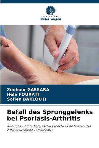Befall des Sprunggelenks bei Psoriasis-Arthritis