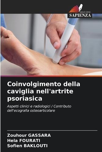 Coinvolgimento della caviglia nell'artrite psoriasica