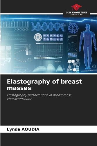 Elastography of breast masses