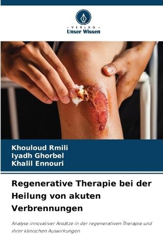 Regenerative Therapie bei der Heilung von akuten Verbrennungen