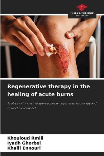Regenerative therapy in the healing of acute burns