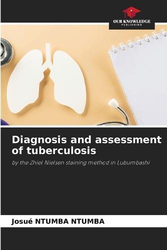 Diagnosis and assessment of tuberculosis