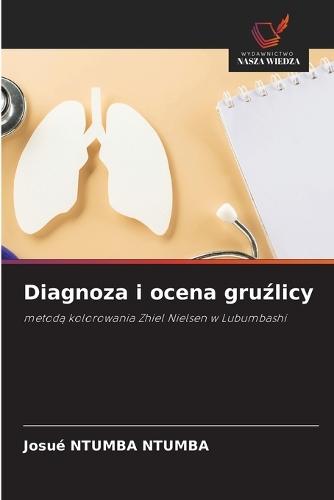 Diagnoza i ocena gruźlicy