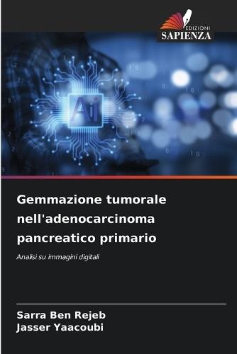Gemmazione tumorale nell'adenocarcinoma pancreatico primario