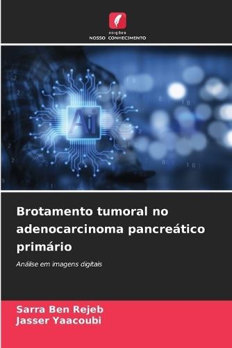 Brotamento tumoral no adenocarcinoma pancreático primário