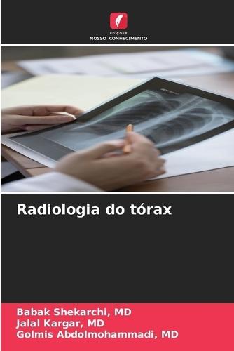 Radiologia do tórax