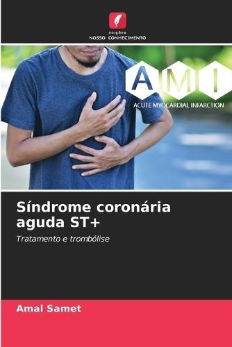 Síndrome coronária aguda ST+